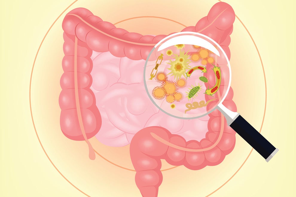Emerging research on the gut microbiome and bone health Emerging research on the gut microbiome and bone health
