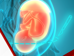 WNSC Learning Lead 2024 C-Section