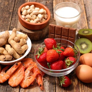 [Literature Library] Human milk oligosaccharide (HMO) profiles and food sensitization among infants in the CHILD Study