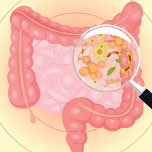 Emerging research on the gut microbiome and bone health