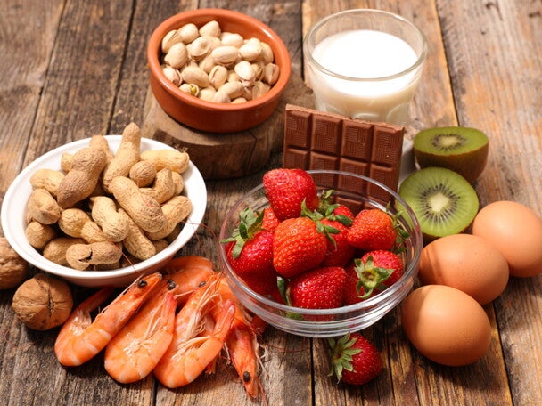 [Literature Library] Human milk oligosaccharide (HMO) profiles and food sensitization among infants in the CHILD Study