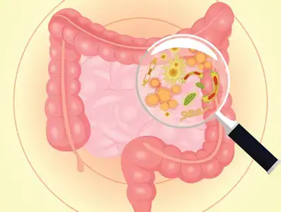 Emerging research on the gut microbiome and bone health